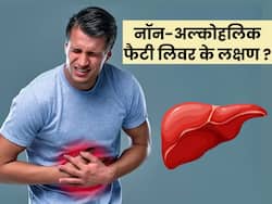 Non-Alcoholic Fatty Liver: आंखों और स्किन का पीला होना खतरनाक बीमारी का है संकेत, समय से पहले करें लक्षणों की सही पहचान