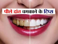 पीले दांतों की वजह से छोड़ दिया है खुलकर मुस्कुराना, तो ट्राई करें 4 नुस्खे, मोतियों से चमक उठेंगे दांत