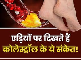 खराब कोलेस्ट्रॉल बढ़ने पर एड़ियों के आसपास दिखते हैं ये 4 लक्षण, नजरअंदाज करने की न करें गलती