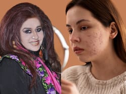 शहनाज हुसैन से जानिए ड्राई स्किन, एक्ने और हाइपरपिग्मेंटेशन को मैनेज करने के तरीके