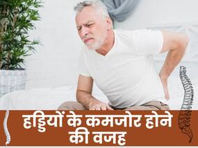 कमजोर होकर चकनाचूर हो जाएंगी हड्डियां, ये 6 बीमारियां हड्डियों को कर देती हैं खोखला कमजोर होकर चकनाचूर हो जाएंगी हड्डियां, ये 6 बीमारियां हड्डियों को कर देती हैं खोखला