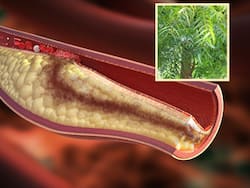 इस पेड़ की छाल से लेकर पत्तियों तक कण-कण में छिपे हैं कोलेस्ट्रॉल कम करने के गुण, बस जान लें सेवन का सही तरीका