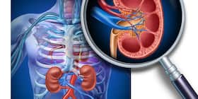 Treatment Of Cancer: How Does It Put An Impact On Kidneys?