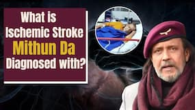 Ischemic Stroke: All about the disease Disco Dancer Mithun Chakraborty has been diagnosed with! Ischemic Stroke: All about the disease Disco Dancer Mithun Chakraborty has been diagnosed with!