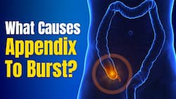Appendicitis: What are the signs, causes, and how to treat it? | Acute Appendicitis | The Healthsite