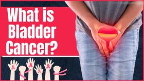 Bladder Cancer: What are the causes of this cancer? How do you reduce the risk of bladder cancer?