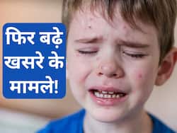 मध्य प्रदेश में तेजी से बढ़े खसरे के मामले, जानिए इसके लक्षण और बचाव के उपाय