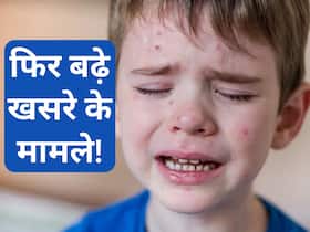 मध्य प्रदेश में तेजी से बढ़े खसरे के मामले, जानिए इसके लक्षण और बचाव के उपाय मध्य प्रदेश में तेजी से बढ़े खसरे के मामले, जानिए इसके लक्षण और बचाव के उपाय