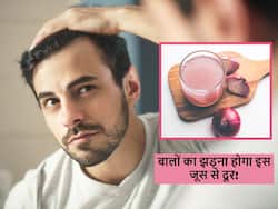 महंगे हेयर प्रोडक्ट्स से भी नहीं रुक रहा हेयर फॉल? जड़ों में करें प्याज के रस की मालिश तो नहीं टूटेंगे बाल