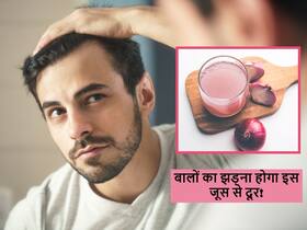 महंगे हेयर प्रोडक्ट्स से भी नहीं रुक रहा हेयर फॉल? जड़ों में करें प्याज के रस की मालिश तो नहीं टूटेंगे बाल