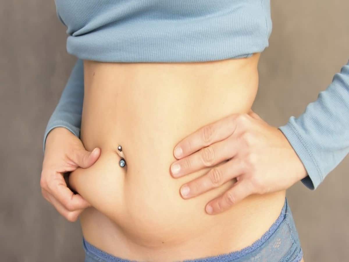Diastasis Recti: Is it normal to have Postpartum Belly Pouch