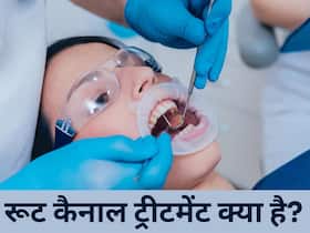 रूट कैनाल ट्रीटमेंट से डरें नहीं, इन आसान स्टेप्स से आपको मिलेगा पूरा आराम