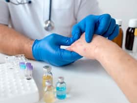Measles Spread: 5 At-Home Tips You Can Undertake To Prevent It From Spreading In The Household Measles Spread: 5 At-Home Tips You Can Undertake To Prevent It From Spreading In The Household