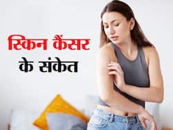 बार-बार स्किन रैशेज होना हो सकता है इस गम्भीर कैंसर का लक्षण, एक्सपर्ट ने बताए स्किन में दिखने वाले कैंसर के लक्षण