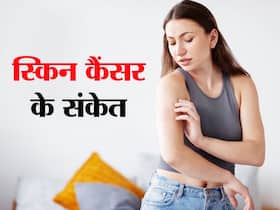 बार-बार स्किन रैशेज होना हो सकता है इस गम्भीर कैंसर का लक्षण, एक्सपर्ट ने बताए स्किन में दिखने वाले कैंसर के लक्षण