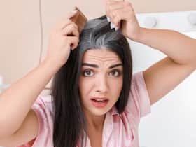 बिना डाय काले करने हैं अपने सफेद बाल तो नारियल तेल में मिलाएं ये 1 चीज, किसी को पता नही चलेगा कि आपने किया है हेयर कलर
