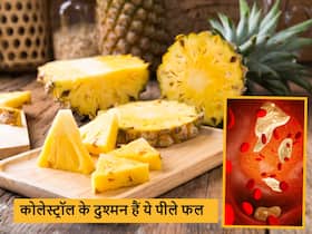 हाई कोलेस्ट्रॉल के जानी दुश्मन हैं पीले रंग के ये 5 फल, धमनियों में जमे LDL को निकालने के लिए रोज खाएं एक फल