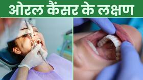Oral Cancer Symptoms: ओरल कैंसर का हो सकते हैं ये संकेत, ना करें Ignore! Oral Cancer Symptoms: ओरल कैंसर का हो सकते हैं ये संकेत, ना करें Ignore!