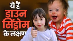Down Syndrome Symptoms: बच्चों में दिखने वाले ये लक्षण हो सकते हैं डाउन सिंड्रोम के
