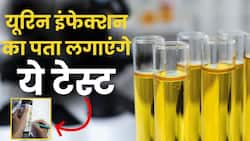Urine Infection Test: महिलाओं में यूटीआई का पता लगाएंगे ये टेस्ट