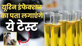 Urine Infection Test: महिलाओं में यूटीआई का पता लगाएंगे ये टेस्ट