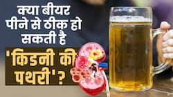 Kidney Stone Beer: क्या पथरी के इलाज में काम आ सकती है बीयर,जानें एक्सपर्ट से!