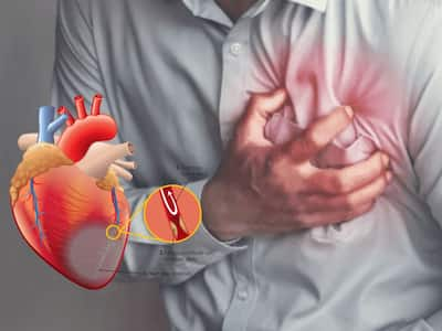 Heart Blockage Symptoms: 7 Warning Signs of Blocked Heart Arteries Due ...