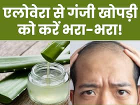 गंजी होती खोपड़ी को भरा-भरा कर सकता है एलोवेरा, सप्ताह में 2 बार बालों में ऐसे करें इस्तेमाल गंजी होती खोपड़ी को भरा-भरा कर सकता है एलोवेरा, सप्ताह में 2 बार बालों में ऐसे करें इस्तेमाल