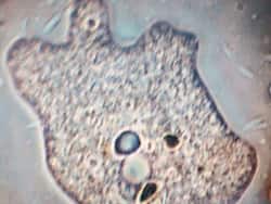 Warning: Nasal Rinses With Tap Water Can Give You Deadly Amoeba Infections