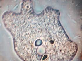 Warning: Nasal Rinses With Tap Water Can Give You Deadly Amoeba Infections