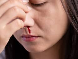 शरीर हो रहा है धीरे-धीरे खोखला तो ब्लीडिंग डिसॉर्डर का है ये लक्षण, इन संकेतों को भी ना करें इग्नोर