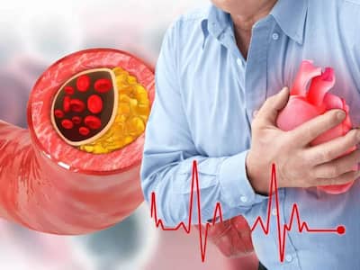 Blocked Heart Arteries: Top 7 Home Remedies To Clean Clogged Heart Naturally Without Medication