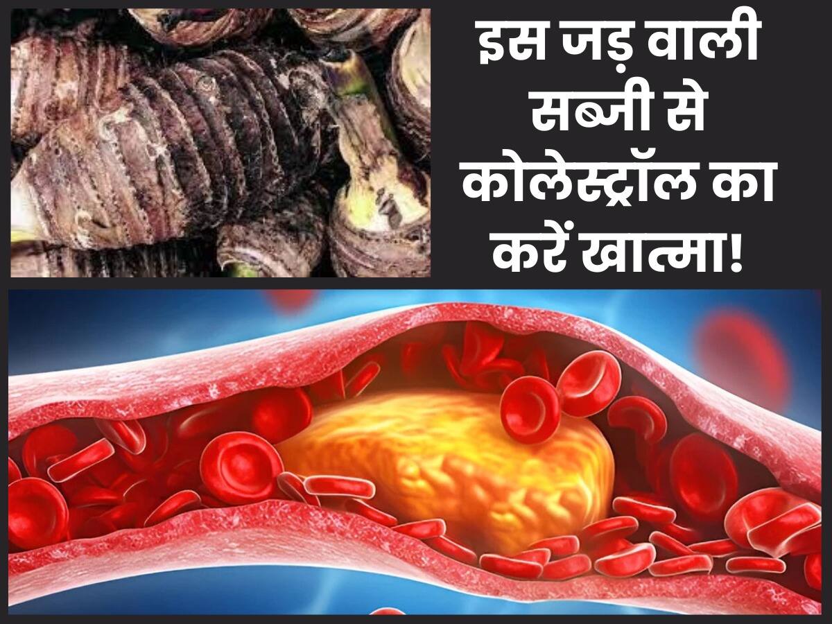 Kharab cholesterol kaise kam kare इस जड़ वाली सब्जी से ब्लड से खराब