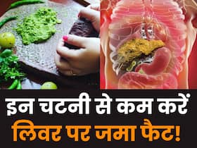 लिवर पर जमा फैट कम करने के लिए खाएं ये 5 तरह की चटनी,  सूजन की परेशान भी होगी कम