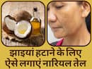 नारियल तेल में ये 3 चीजें मिलाकर चेहरे पर लगाएं, दाग-धब्बों और झाइयों का मिट जाएगा नामोनिशान   