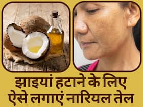 नारियल तेल में ये 3 चीजें मिलाकर चेहरे पर लगाएं, दाग-धब्बों और झाइयों का मिट जाएगा नामोनिशान   
