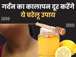 गर्दन का कालापन बन रहा है शर्मिंदगी का कारण? ट्राई करें ये आसान घरेलू उपाय, 10 मिनट में दिखने लगेगा असर