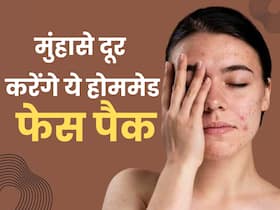 पिंपल्स और एक्ने से छुटकारा पाने के लिए लगाएं ये 3 होममेड फेस पैक, सब लोग पूछेंगे चेहरे की चमक का राज पिंपल्स और एक्ने से छुटकारा पाने के लिए लगाएं ये 3 होममेड फेस पैक, सब लोग पूछेंगे चेहरे की चमक का राज