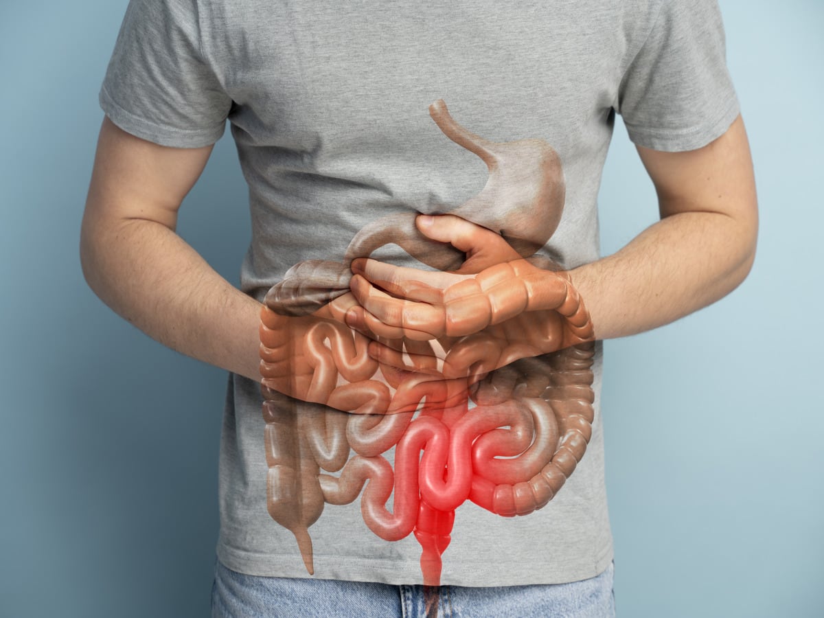 Colorectal Cancer Causes, Colorectal cancer, Colorectal Cancer Symptoms, Cancer awareness month, Colorectal Cancer Awareness Month, Colorectal Cancer signs and symptoms, Colorectal Cancer diagnosis, Colorectal Cancer treatment strategies