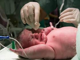 What Is Delayed Cord Clamping And How Does It Benefit The Newborn?