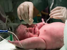What Is Delayed Cord Clamping And How Does It Benefit The Newborn?