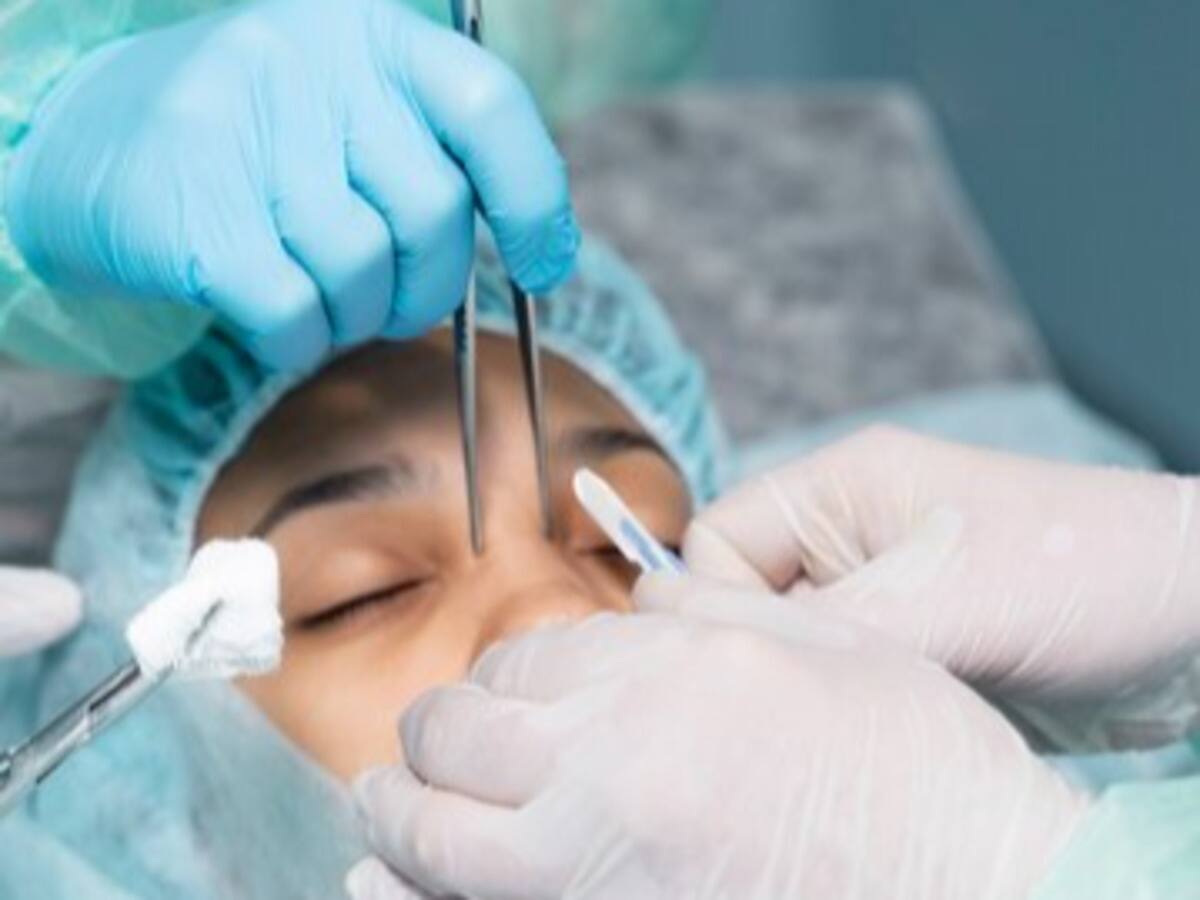 Rhinoplasty, nose job, nose reshaping surgery, nasal refinement surgery, what is rhinoplasty, when is rhinoplasty needed, rhinoplasty purpose, rhinoplasty surgery, rhinoplasty surgery method, rhinoplasty cosmetic surgery, rhinoplasty medical surgery, medical reasons for rhinoplasty