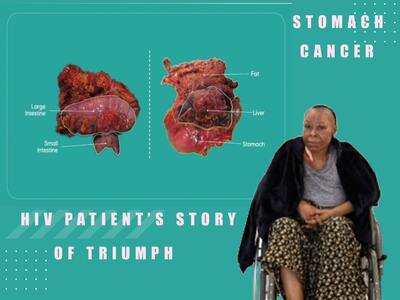 A Journey Of Triumph: How A 51-Year-Old HIV Patient Overcomes Stomach ...