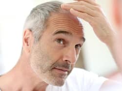 Top 5 Ayurvedic Homemade Drinks With Zero Side Effects to Stop Hair Loss Now