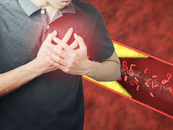 Heart Blockage Ayurvedic Remedies: Top 7 Drinks To Unclog Blocked Heart Arteries And Prevent Stroke