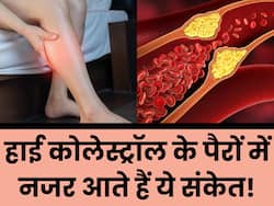 पैरों में दिखने वाले ये 4 बदलाव बताते हैं नसों में भर चुका है बैड कोलेस्ट्रॉल, इग्नोर किया तो आ सकता है हार्ट अटैक