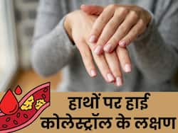 हाई कोलेस्ट्रॉल बिगाड़ सकता है आपके नाखूनों की खूबसूरती, हाथों पर दिखते हैं बैड कोलेस्ट्रॉल के ये 5 लक्षण