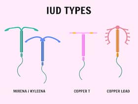 Are Intra-Uterine Devices Painful? Here's What You Need To Know About The Safest Method Of Contraception