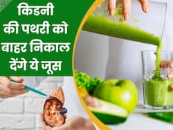 किडनी की पथरी को दूर करने में फायदेमंद हैं ये 5 तरह के जूस, बिना ऑपरेशन के निकल जाएगा स्टोन