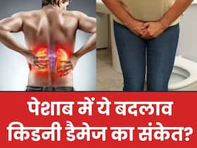 किडनी फेल होने से पहले पेशाब में दिखते हैं ये 3 अंतर, पैरों में भी आ जाती है सूजन किडनी फेल होने से पहले पेशाब में दिखते हैं ये 3 अंतर, पैरों में भी आ जाती है सूजन